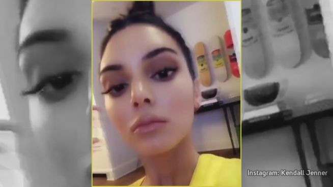 Künstlich gemacht? Kendall Jenner feuert zurück